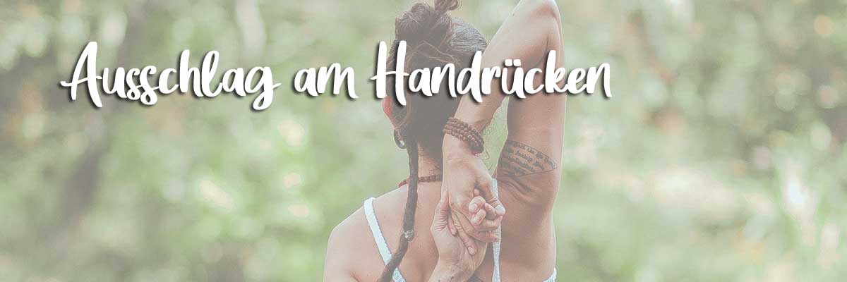 Ausschlag-am-Handrücken Ausschlag am Handrücken