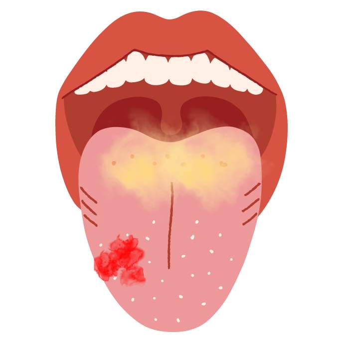 Wie sieht deine Zunge ungefähr aus?